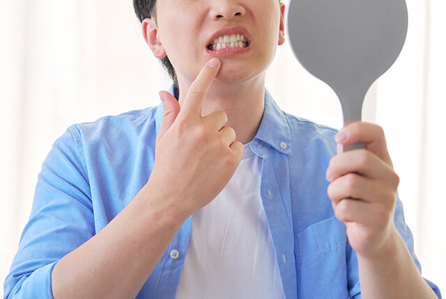 歯の状態を鏡で確認する男性