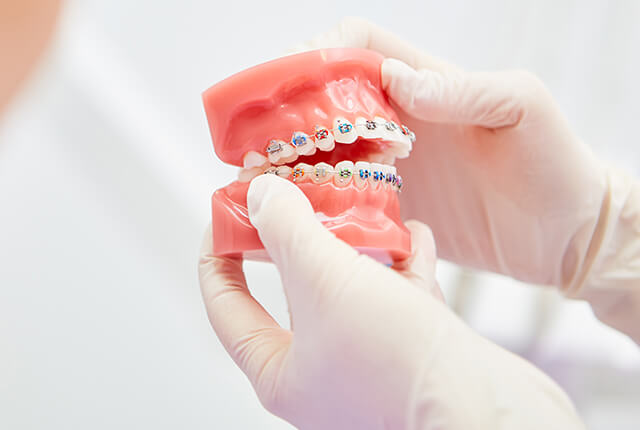 矯正装置を装着した歯の模型