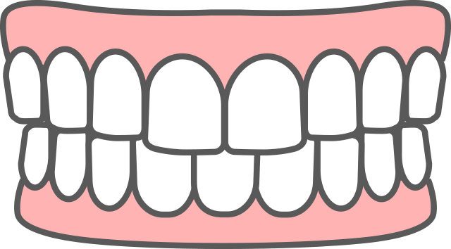 鋏（はさみ）状咬合 イラスト