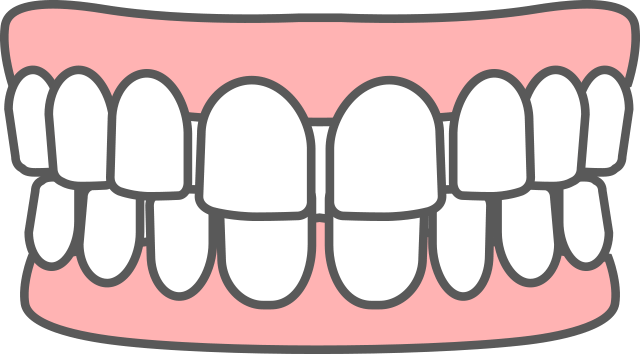 正中離開 すきっ歯 イラスト