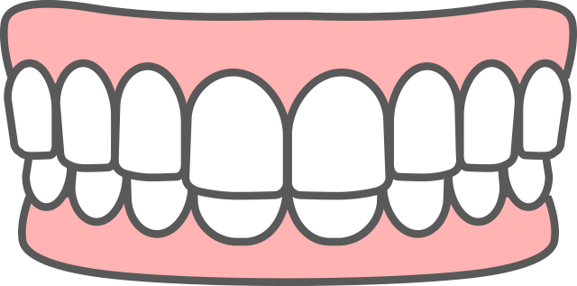 過蓋咬合 深い噛み合わせ イラスト